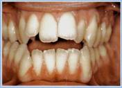 ortodoncia 